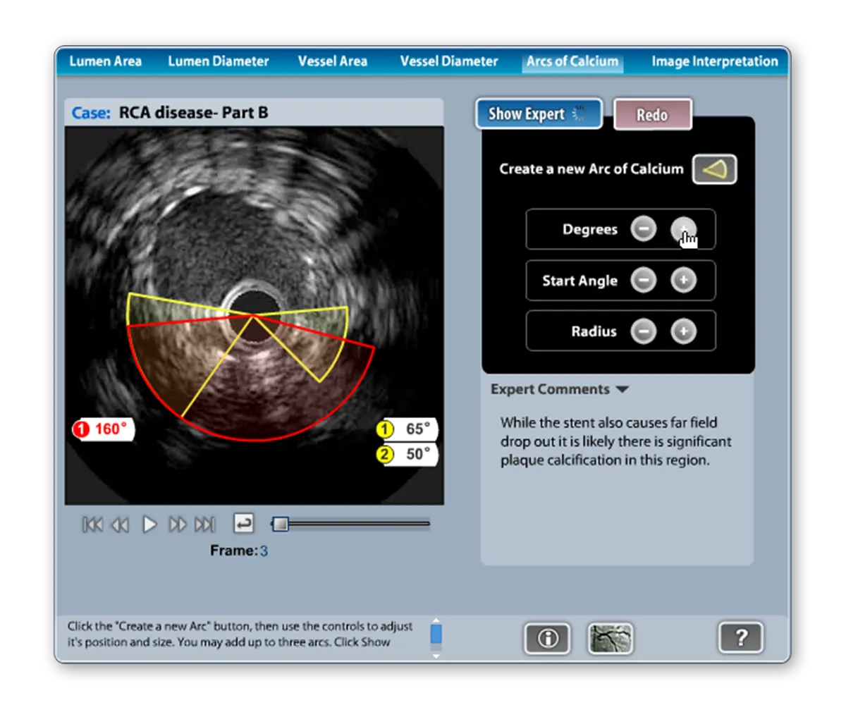 TeachIVUS software screenshot